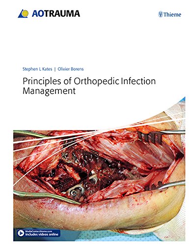 Principles of Orthopedic Infection Management (Hardcover)