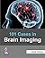 101 Cases in Brain Imaging