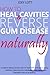 How to Heal Cavities and Reverse Gum Disease Naturally: a science-based, proven plan to heal teeth and gums using nutrition, balancing the metabolism, and natural therapies such as oil pulling