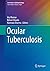 Ocular Tuberculosis
