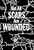 Not All Scars Are Wounded