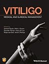 Vitiligo: Medical and Surgical Management