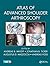 Atlas of Advanced Shoulder Arthroscopy
