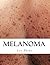 Melanoma