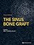 The Sinus Bone Graft