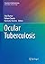 Ocular Tuberculosis