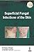 Superficial Fungal Infectio...
