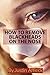 How to Remove Blackheads on...