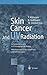 Skin Cancer and UV Radiation