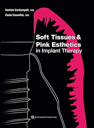 Soft Tissues and Pink Esthetics in Implant Therapy