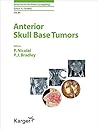 Anterior Skull Base Tumors (Advances in Oto-Rhino-Laryngology)