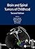 Brain and Spinal Tumors of ...