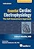 Essential Cardiac Electrophysiology, Third Edition by Zainul Abedin