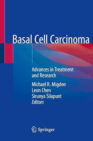 Basal Cell Carcinoma: Advances in Treatment and Research