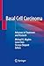 Basal Cell Carcinoma: Advances in Treatment and Research