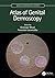 Atlas of Genital Dermoscopy (Series in Dermatological Treatment)