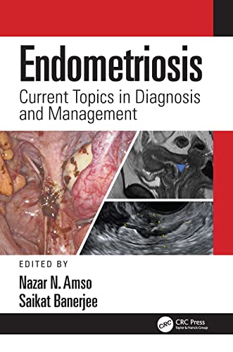 Endometriosis: Current Topics in Diagnosis and Management (Kindle Edition)