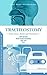 Tracheostomy by Amit Agrawal