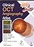 Clinical OCT Angiography Atlas