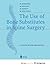 The Use of Bone Substitutes in Spine Surgery: A State of the Art Review