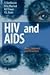 HIV and AIDS