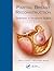Partial Breast Reconstruction: Techniques in Oncoplastic Surgery, 2nd Edition