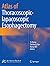 Atlas of Thoracoscopic-lapacoscopic Esophagectomy