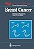 Breast Cancer