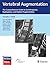 Vertebral Augmentation: The Comprehensive Guide to Vertebroplasty, Kyphoplasty, and Implant Augmentation