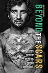 Beyond the Scars:...
