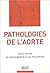 pathologies de l'aorte