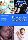 Echographie : Mode d'emploi