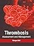 Thrombosis: Assessment and ...