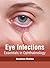 Eye Infections: Essentials in Ophthalmology