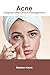 Acne: Diagnosis and Clinica...