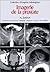 Imagerie de la prostate