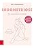 Endometriose – Die untersch...