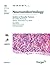 Update on Parasellar Tumour...