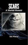 Scars: A Morbid Memoir Scars: A Morbid Memoir