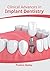 Clinical Advances in Implant Dentistry