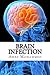 Brain Infection: An LUA Pro...