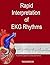 Rapid Interpretation of EKG...