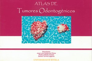 Atlas de Tumores Odontogénicos (Paperback)