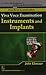 Viva Voice Examination Instruments And Implants by Ebnezar John