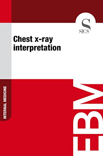 Chest X-ray Interpretation (Kindle Edition)