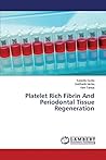 Platelet Rich Fibrin And Periodontal Tissue Regeneration