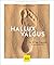 Hallux Valgus: Das 28-Tage-...
