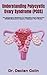 Understanding Polycystic Ovary Syndrome (PCOS): The Caregiver's Handbook To Polycystic Ovary Syndrome (PCOS) (Alternative Healthy Treatment That Works)