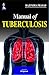 Manual of Tuberculosis