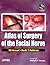 Atlas of Surgery of the Fac...